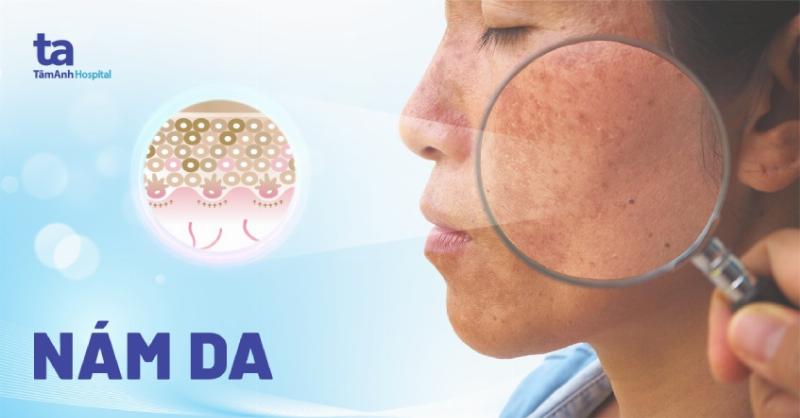 Các yếu tố ảnh hưởng đến giá trị của ngọc: Minh họa các yếu tố như màu sắc, độ trong, kích thước và kiểu chế tác ảnh hưởng đến giá trị của ngọc bích và cẩm thạch.